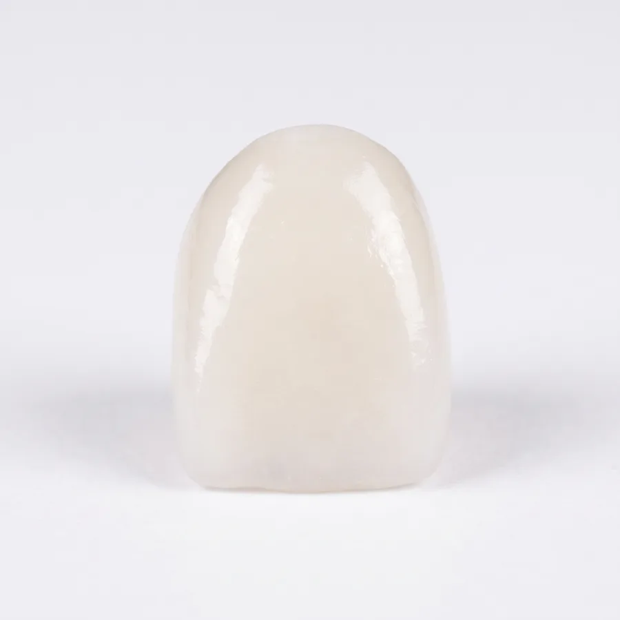 Corona de cerámica de un implante dental